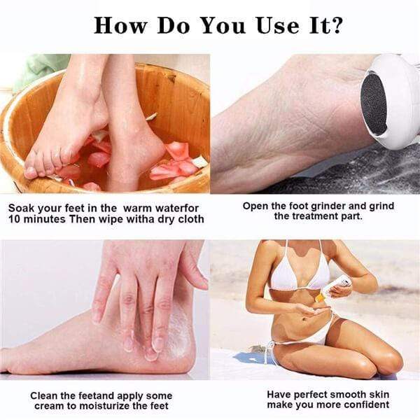 [🔥LAST PROMOTION&50% OFF] Electric Pedivac - Remove Your Callus Easily